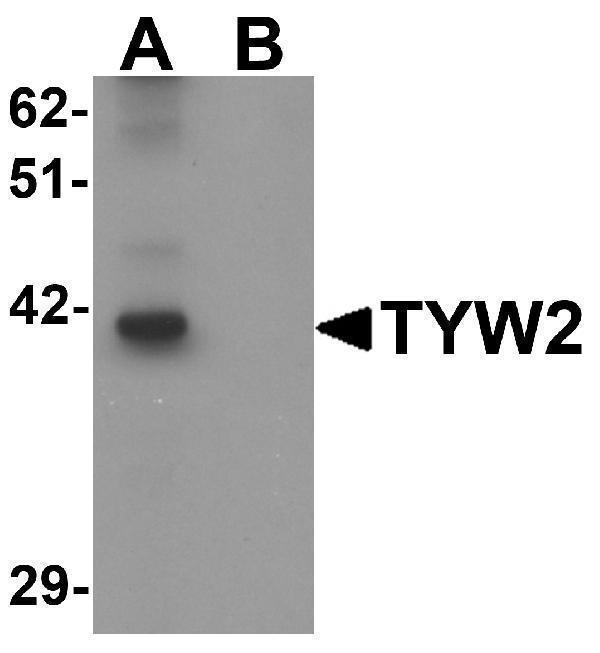 Western blot analysis of TYW2 in K562 cell lysate with TYW2 antibody at 0
