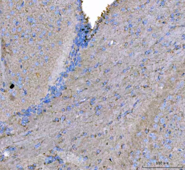 Figure 3. IHC analysis of MAP6D1 using anti-MAP6D1 antibody (A15534-1). MAP6D1 was detected in a paraffin-embedded section of mouse brain tissue. Heat mediated antigen retrieval was performed in EDTA buffer (pH 8.0, epitope retrieval solution). The tissue section was blocked with 10% goat serum. The tissue section was then incubated with 2 microg/ml rabbit anti-MAP6D1 Antibody (A15534-1) overnight at 4°C. Peroxidase Conjugated Goat Anti-rabbit IgG was used as secondary antibody and incubated for 30 minutes at 37°C. The tissue section was developed using HRP Conjugated Rabbit IgG Super Vision Assay Kit (Catalog # SV0002) with DAB as the chromogen. Figure 3. IHC analysis of MAP6D1 using anti-MAP6D1 antibody (A15534-1). MAP6D1 was detected in a paraffin-embedded section of mouse brain tissue. Heat mediated antigen retrieval was performed in EDTA buffer (pH 8.0, epitope retrieval solution). The tissue section was blocked with 10% goat serum. The tissue section was then incubated with 2 microg/ml rabbit anti-MAP6D1 Antibody (A15534-1) overnight at 4°C. Peroxidase Conjugated Goat Anti-rabbit IgG was used as secondary antibody and incubated for 30 minutes at 37°C. The tissue section was developed using HRP Conjugated Rabbit IgG Super Vision Assay Kit (Catalog # SV0002) with DAB as the chromogen.