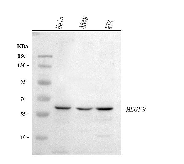 Figure 1. Western blot analysis of MEGF9 using anti-MEGF9 antibody (A15544-2). Electrophoresis was performed on a 5-20% SDS-PAGE gel at 70V (Stacking gel) / 90V (Resolving gel) for 2-3 hours. The sample well of each lane was loaded with 30 ug of sample under reducing conditions. Lane 1: human Hela whole cell lysates, Lane 2: human A549 whole cell lysates, Lane 3: human RT4 whole cell lysates. After electrophoresis, proteins were transferred to a nitrocellulose membrane at 150 mA for 50-90 minutes. Blocked the membrane with 5% non-fat milk/TBS for 1.5 hour at RT. The membrane was incubated with rabbit anti-MEGF9 antigen affinity purified polyclonal antibody (Catalog # A15544-2) at 0.5 microg/mL overnight at 4°C, then washed with TBS-0.1%Tween 3 times with 5 minutes each and probed with a goat anti-rabbit IgG-HRP secondary antibody at a dilution of 1:5000 for 1.5 hour at RT. The signal is developed using an Enhanced Chemiluminescent detection (ECL) kit (Catalog # EK1002) with Tanon 5200 system. A specific band was detected for MEGF9 at approximately 63 kDa. The expected band size for MEGF9 is at 63 kDa.