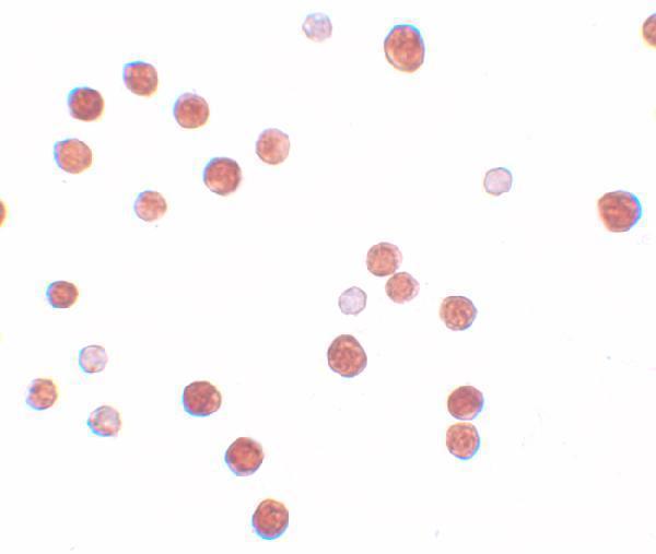 Immunocytochemistry of PLAC4 in HeLa cells with PLAC4 antibody at 10 μg/mL