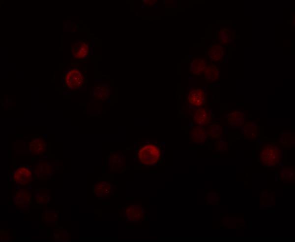 Immunofluorescence of PLAC4 in HeLa cells with PLAC4 antibody at 20 μg/mL