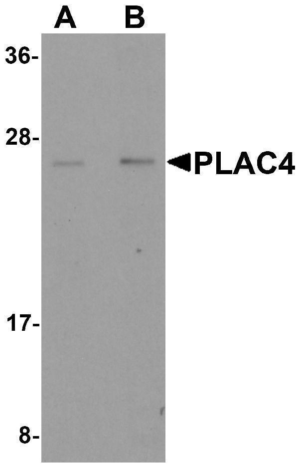 Western blot analysis of PLAC4 in human placenta tissue lysate with PLAC4 antibody at (A) 1 and (B) 2 μg/mL