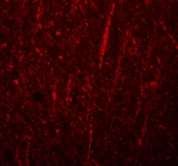 a15565 frmpd4 primary antibodies if testing 3