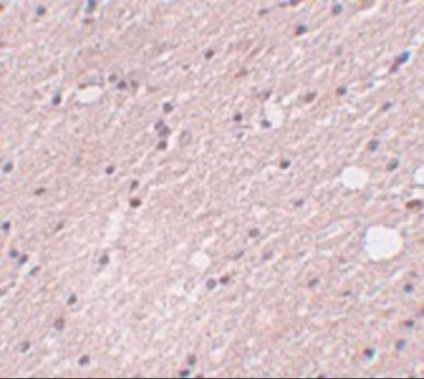 a15565 frmpd4 primary antibodies ihc testing 2