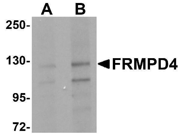 a15565 frmpd4 primary antibodies wb testing 1