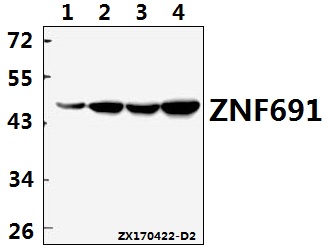 Western blot (WB) analysis of ZNF691 polyclonal antibody at 1:500 dilution
Lane1:MCF-7 whole cell lysate(40ug)
Lane2:HepG2 whole cell lysate(40ug)
Lane3:PC12 whole cell lysate(40ug)
Lane4:MEF whole cell lysate(40ug)