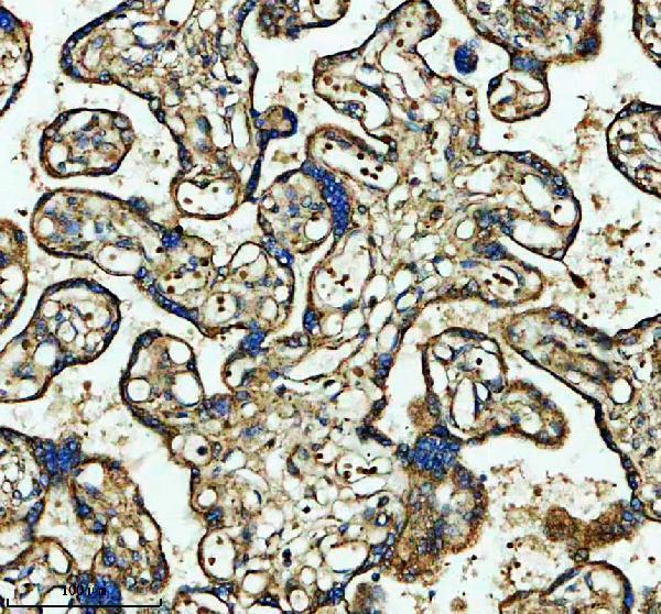a15576 1 fbxo8 primary antibodies ihc testing 1
