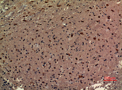 a15583 rrp7a primary antibodies ihc testing 1