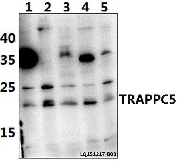 Western blot (WB) analysis of TRAPPC5 polyclonal antibody at 1:500 dilution
Lane1:H9C2 whole cell lysate(40ug)
Lane2:HEK293T whole cell lysate(40ug)
Lane3:NIH-3T3 whole cell lysate(40ug)
Lane4:PC12 whole cell lysate(40ug)
Lane5:Hela whole cell lysate(40ug)