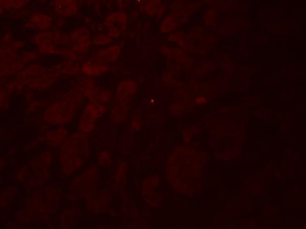 a15598 glipr1l2 primary antibodies if testing 3