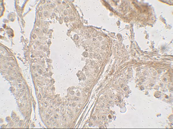 a15598 glipr1l2 primary antibodies ihc testing 2