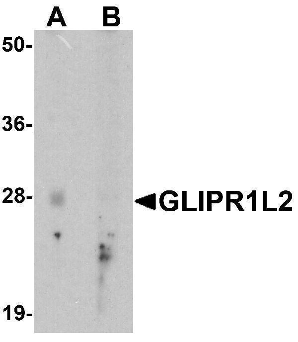 a15598 glipr1l2 primary antibodies wb testing 1