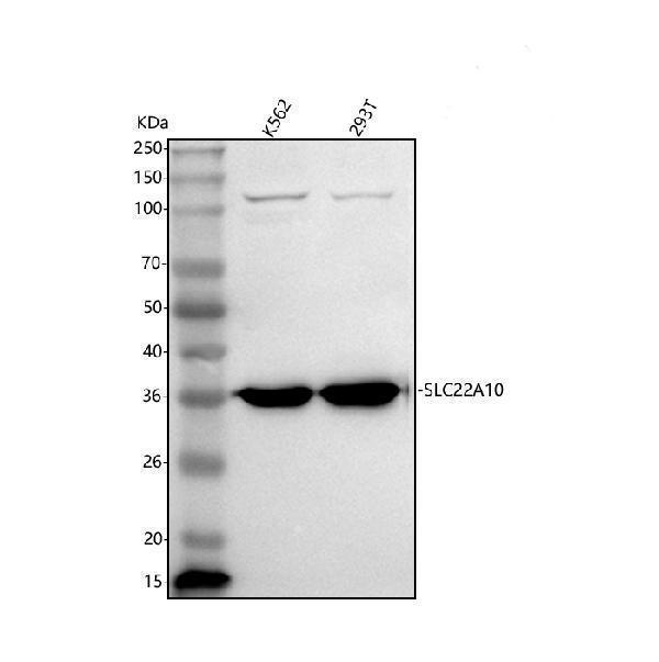  Western blot analysis of SLC22A10 using anti-SLC22A10 antibody (A15610-1)