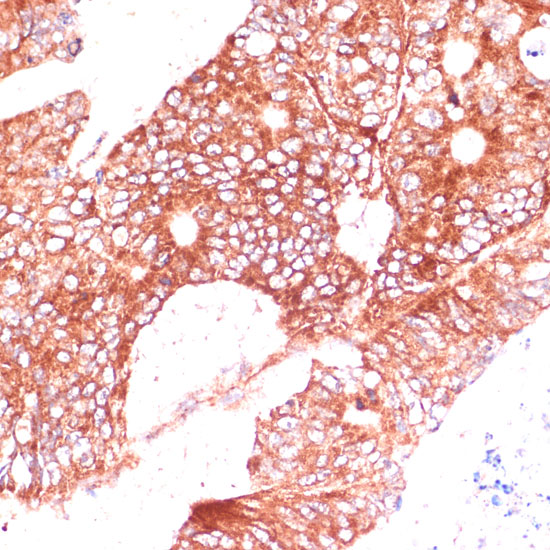 a15624 fam98a primary antiboties ihc testing 2
