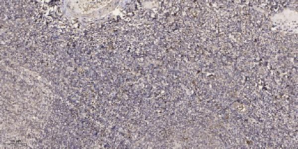 a15661 c1qtnf8 primary antibodies ihc testing 1