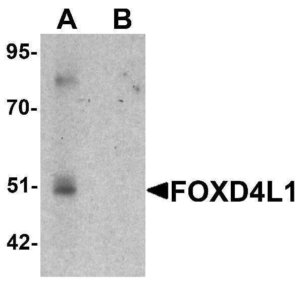 Western blot analysis of FOXD4L1 in A-20 cell lysate with FOXD4L1 antibody at 1 μg/mL in (A) the absence and (B) the presence of blocking peptide