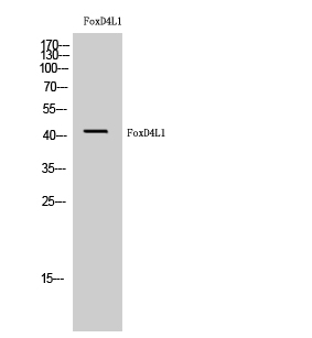 Western Blot analysis of HuvEc cells using FoxD4L1 Polyclonal Antibody cells nucleus extracted by Minute TM Cytoplasmic and Nuclear Fractionation kit 