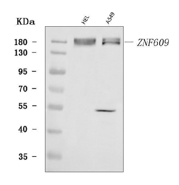  Western blot analysis of ZNF609 using anti-ZNF609 antibody (A15674-2)