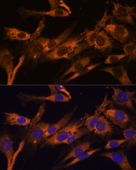 a15679 rpl36al primary antiboties if testing 2