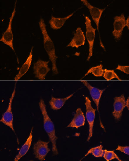 a15679 rpl36al primary antiboties if testing 3