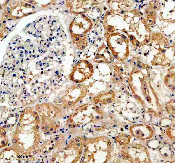a15684 1 slc25a44 primary antibodies ihc testing 1