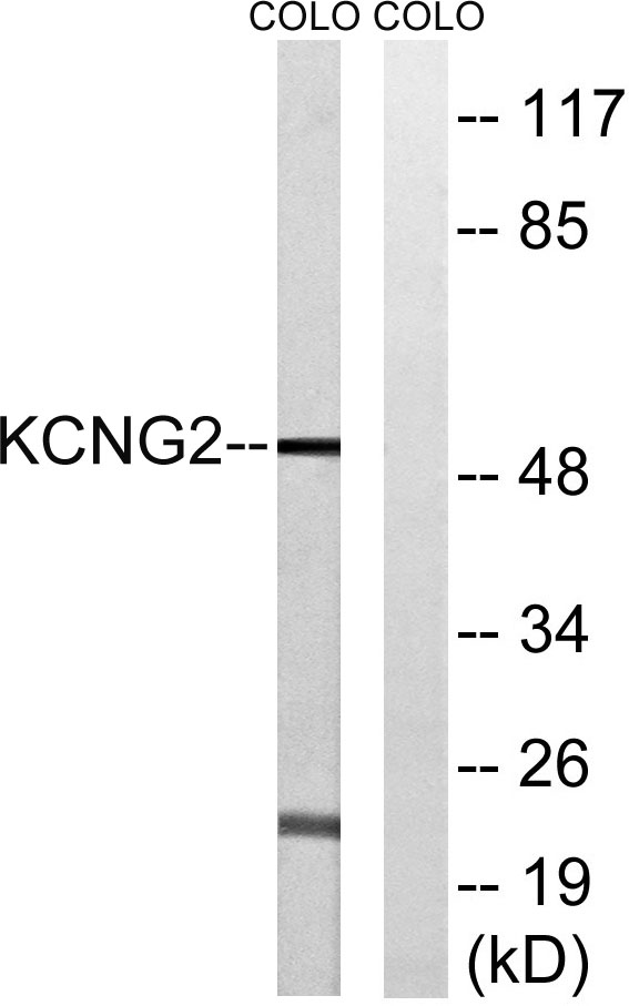 a15685 kcng2 primary antibodies wb testing 3