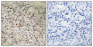a15695 pbov1 primary antibodies ihc testing 1