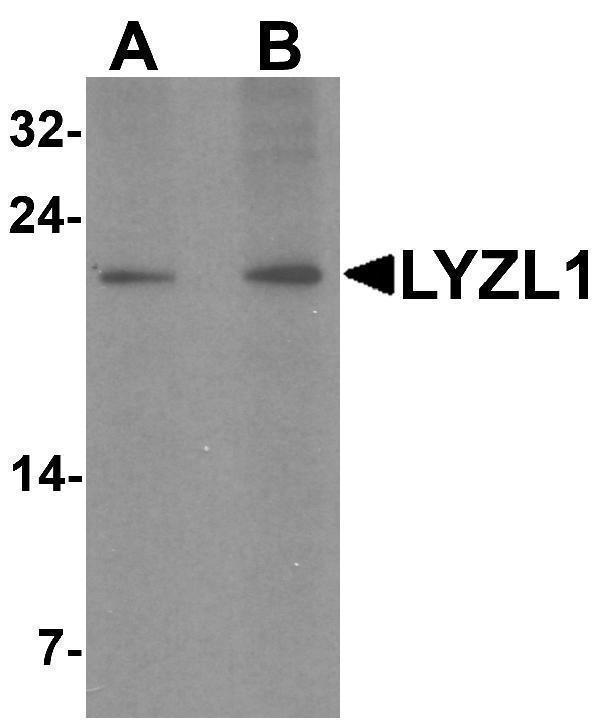 a15700 lyzl1 primary antibodies wb testing 1