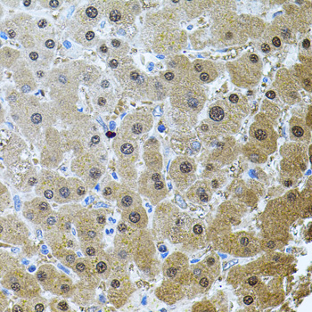 a15709 rnf166 primary antiboties ihc testing 2