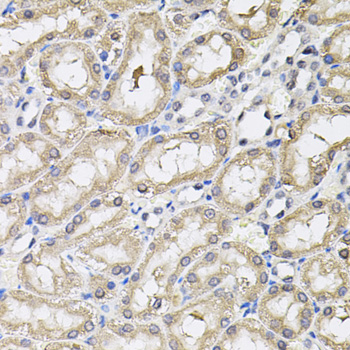 a15709 rnf166 primary antiboties ihc testing 4