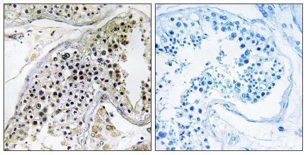 Immunohistochemistryt analysis of paraffin-embedded human testis, using PABPC3 Antibody