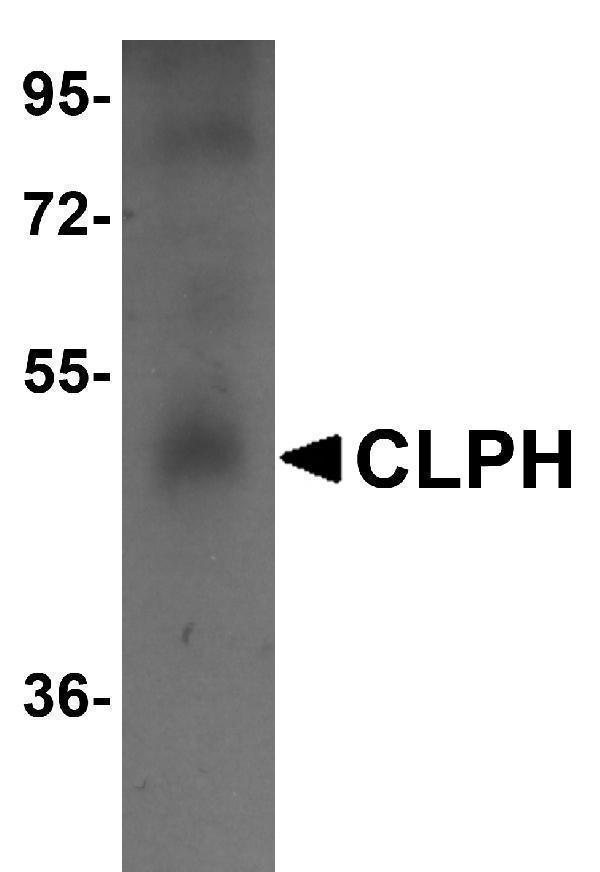 Western blot analysis of CLPH in human testis tissue lysate with CLPH antibody at 1 μg/mL