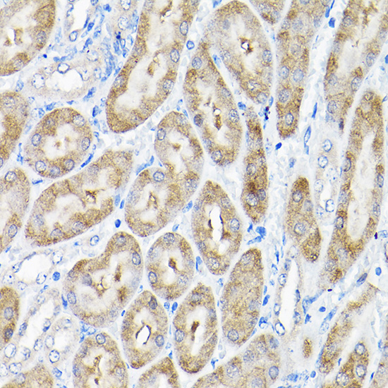 Immunohistochemistry of paraffin-embedded mouse kidney using THUMPD3 Rabbit pAb  at dilution of 1:200 