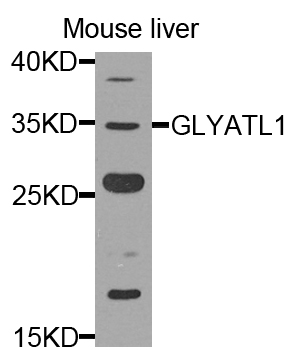 a15722 glyatl1 primary antiboties wb testing 1