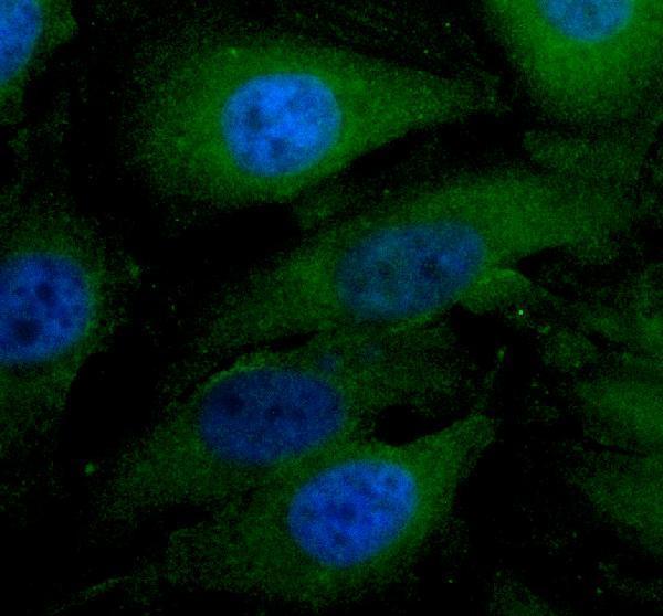 a15723 1 dcaf16 primary antibodies if testing 1