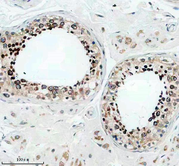 a15723 1 dcaf16 primary antibodies ihc testing 1