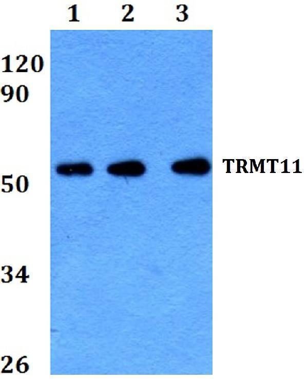Western blot (WB) analysis of TRMT11 polyclonal antibody at 1:500 dilution
Lane1:HEK293T whole cell lysate
Lane2:Raw264