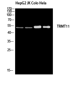 Western blot analysis of HepG2 JK Colo Hela using TRMT11 antibody