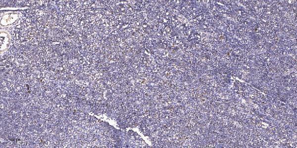a15727 1 prpf39 primary antibodies ihc testing 1