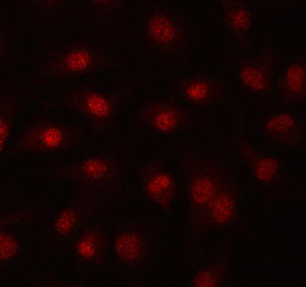 Figure 2. IF analysis of PRPF39 using anti-PRPF39 antibody (A15727-2). PRPF39 was detected in an immunocytochemical section of A549 cells. Enzyme antigen retrieval was performed using IHC enzyme antigen retrieval reagent (AR0022) for 15 mins. The cells were blocked with 10% goat serum. And then incubated with 5 microg/mL rabbit anti-PRPF39 Antibody (A15727-2) overnight at 4°C. Cy3 Conjugated Goat Anti-Rabbit IgG (BA1032) was used as secondary antibody at 1:500 dilution and incubated for 30 minutes at 37°C. Visualize using a fluorescence microscope and filter sets appropriate for the label used.