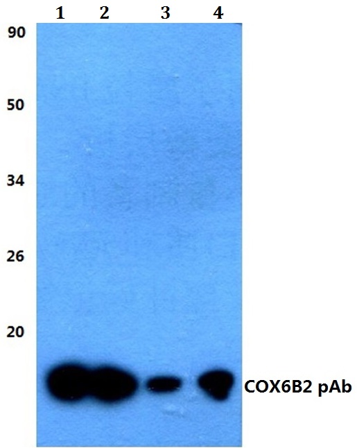 Western blot (WB) analysis of COX6B2 polyclonal antibody at 1:500 dilution
Lane1:HEK293T whole cell lysate
Lane2:sp2/0 whole cell lysate
Lane3:H9C4 whole cell lysate
