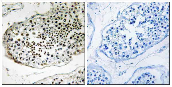 a15748 ubqln3 primary antibodies ihc testing 1