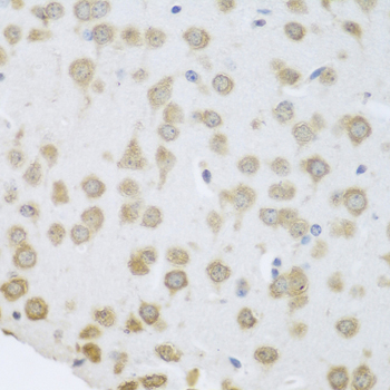 Immunohistochemistry of paraffin-embedded human colon carcinoma using GRPEL2 Rabbit pAb  at dilution of 1:200 