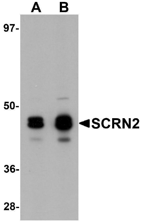 a15761 scrn2 primary antibodies wb testing 1