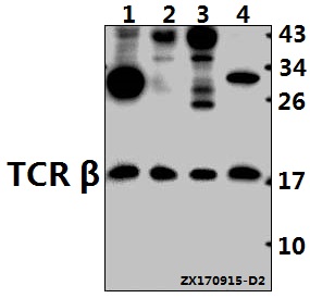Western blot (WB) analysis of TCR β (K115) pAb at 1:500 dilution
Lane1:H1792 whole cell lysate(40ug)
Lane2:Hela whole cell lysate(40ug)
Lane3:H9C2 whole cell lysate(40ug)
Lane4:3T3-L1 whole cell lysate(40ug)