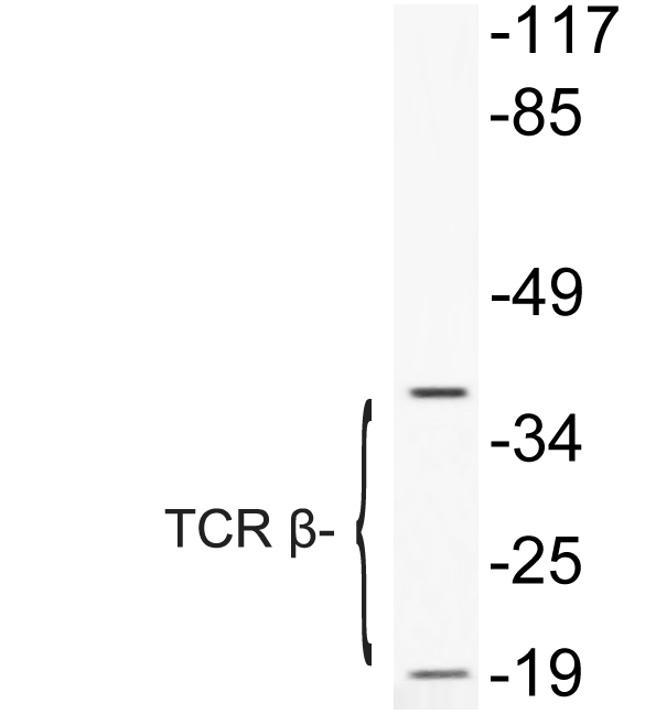 Western blot analysis of lysate from COLO205 cells treated with Forskolin, using TCR β antibody