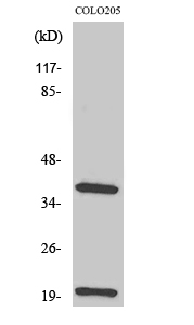 Western Blot analysis of various cells using TCR β Polyclonal Antibody