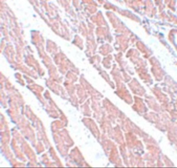 Immunohistochemistry of TMEM184C in mouse heart tissue with TMEM184C antibody at 5 μg/mL