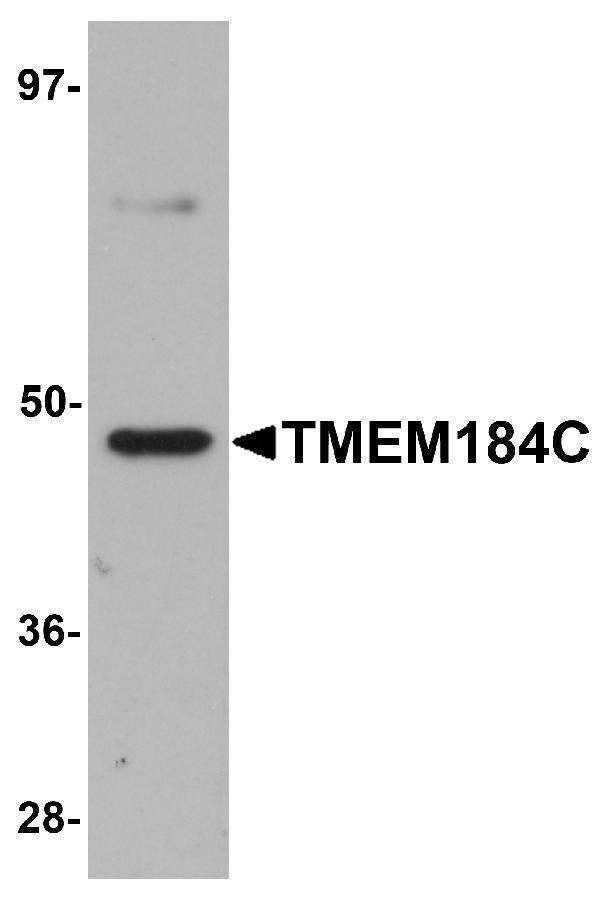 Western blot analysis of TMEM184C in mouse heart tissue lysate with TMEM184C antibody at 1 μg/mL