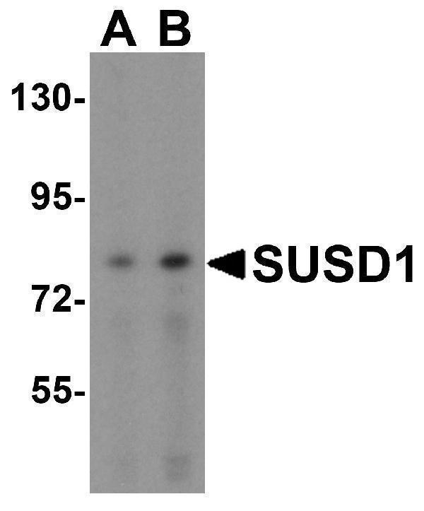 Western blot analysis of SUSD1 in 293 cell lysate with SUSD1 antibody at (A) 0